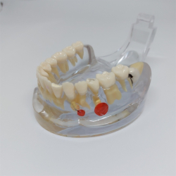 Transparent Sygdomsmodel